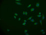 Immunofluorescence staining of Hela cell with CAC11959 at 1:50, counter-stained with DAPI. The cells were fixed in 4% formaldehyde and blocked in 10% normal Goat Serum. The cells were then incubated with the antibody overnight at 4°C. The secondary antibody was Alexa Fluor 570-congugated AffiniPure Goat Anti-Rabbit IgG(H+L).