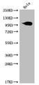 Western Blot; Positive WB detected in: Hela whole cell lysate; All lanes: ACO1 antibody at 1:2000; Secondary; Goat polyclonal to rabbit IgG at 1/50000 dilution; Predicted band size: 100 kDa; Observed band size: 95-130 kDa