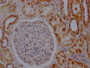 IHC image of CAC11962 diluted at 1:100 and staining in paraffin-embedded human kidney tissue performed on a Leica BondTM system. After dewaxing and hydration, antigen retrieval was mediated by high pressure in a citrate buffer (pH 6.0). Section was blocked with 10% normal goat serum 30min at RT. Then primary antibody (1% BSA) was incubated at 4? overnight. The primary is detected by a Goat anti-rabbit IgG polymer labeled by HRP and visualized using 0.05% DAB.