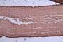 IHC image of diluted at 1:50 and staining in paraffin-embedded human skeletal muscle tissue performed on a Leica BondTM system. After dewaxing and hydration, antigen retrieval was mediated by high pressure in a citrate buffer (pH 6.0). Section was blocked with 10% normal goat serum 30min at RT. Then primary antibody (1% BSA) was incubated at 4°C overnight. The primary is detected by a Goat anti-rabbit polymer IgG labeled by HRP and visualized using 0.72% DAB.
