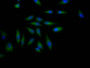 Immunofluorescence staining of Hela Cells with CAC11967 at 1:50, counter-stained with DAPI. The cells were fixed in 4% formaldehyde, permeated by 0.2% TritonX-100, and blocked in 10% normal Goat Serum. The cells were then incubated with the antibody overnight at 4?. Nuclear DNA was labeled in blue with DAPI. The secondary antibody was FITC-conjugated AffiniPure Goat Anti-Rabbit IgG (H+L).