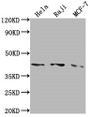 Western Blot; Positive WB detected in: Hela whole cell lysate, Raji whole cell lysate, MCF-7 whole cell lysate; All lanes: AGTR1 antibody at 1:2000; Secondary; Goat polyclonal to rabbit IgG at 1/50000 dilution; Predicted band size: 42 kDa; Observed band size: 42 kDa