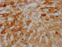 IHC image of CAC11974 diluted at 1:100 and staining in paraffin-embedded human liver tissue performed on a Leica BondTM system. After dewaxing and hydration, antigen retrieval was mediated by high pressure in a citrate buffer (pH 6.0). Section was blocked with 10% normal goat serum 30min at RT. Then primary antibody (1% BSA) was incubated at 4? overnight. The primary is detected by a Goat anti-rabbit IgG polymer labeled by HRP and visualized using 0.05% DAB.