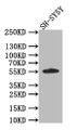 Western Blot; Positive WB detected in: SH-SY5Y whole cell lysate; All lanes: CD44 antibody at 1:1000; Secondary; Goat polyclonal to rabbit IgG at 1/50000 dilution; Predicted band size: 56 kDa; Observed band size: 56 kDa