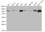 Western Blot; Positive WB detected in: PC3 whole cell lysate, HepG2 whole cell lysate, MCF-7 whole cell lysate, U251 whole cell lysate, A549 whole cell lysate, HEK293 whole cell lysate, Ntera-2 whole cell lysate, Mouse brain tissue; All lanes: ALCAM antibody at 1:2000; Secondary; Goat polyclonal to rabbit IgG at 1/50000 dilution; Predicted band size: 66, 64, 16, 34 kDa; Observed band size: 100 kDa