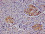 IHC image of CAC11979 diluted at 1:100 and staining in paraffin-embedded human pancreatic tissue performed on a Leica BondTM system. After dewaxing and hydration, antigen retrieval was mediated by high pressure in a citrate buffer (pH 6.0). Section was blocked with 10% normal goat serum 30min at RT. Then primary antibody (1% BSA) was incubated at 4°C overnight. The primary is detected by a Goat anti-rabbit polymer IgG labeled by HRP and visualized using 0.05% DAB.