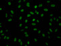 Immunofluorescence staining of Hela Cells with CAC11981 at 1:50, counter-stained with DAPI. The cells were fixed in 4% formaldehyde, permeated by 0.2% TritonX-100, and blocked in 10% normal Goat Serum. The cells were then incubated with the antibody overnight at 4?. Nuclear DNA was labeled in blue with DAPI. The secondary antibody was FITC-conjugated AffiniPure Goat Anti-Rabbit IgG (H+L).