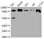 Western Blot; Positive WB detected in: L02 whole cell lysate, HepG2 whole cell lysate, PC-3 whole cell lysate, U-87 whole cell lysate, Rat Liver whole cell lysate; All lanes: ALIX antibody at 1:1000; Secondary; Goat polyclonal to rabbit IgG at 1/50000 dilution; Predicted band size: 97, 97, 31 kDa; Observed band size: 97 kDa
