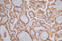 IHC image of CAC11984 diluted at 1:50 and staining in paraffin-embedded human placenta tissue performed on a Leica BondTM system. After dewaxing and hydration, antigen retrieval was mediated by high pressure in a citrate buffer (pH 6.0). Section was blocked with 10% normal goat serum 30min at RT. Then primary antibody (1% BSA) was incubated at 4°C overnight. The primary is detected by a Goat anti-rabbit polymer IgG labeled by HRP and visualized using 0.39% DAB.