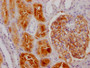 IHC image of CAC11985 diluted at 1:100 and staining in paraffin-embedded human kidney tissue performed on a Leica BondTM system. After dewaxing and hydration, antigen retrieval was mediated by high pressure in a citrate buffer (pH 6.0). Section was blocked with 10% normal goat serum 30min at RT. Then primary antibody (1% BSA) was incubated at 4? overnight. The primary is detected by a Goat anti-rabbit IgG polymer labeled by HRP and visualized using 0.05% DAB.