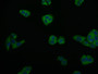 Immunofluorescence staining of PC-3 cell with CAC11996 at 1:50, counter-stained with DAPI. The cells were fixed in 4% formaldehyde and blocked in 10% normal Goat Serum. The cells were then incubated with the antibody overnight at 4°C. The secondary antibody was Alexa Fluor 559-congugated AffiniPure Goat Anti-Rabbit IgG(H+L).