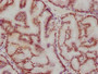 IHC image of CAC12000 diluted at 1:115.5 and staining in paraffin-embedded human prostate tissue performed on a Leica BondTM system. After dewaxing and hydration, antigen retrieval was mediated by high pressure in a citrate buffer (pH 6.0). Section was blocked with 10% normal goat serum 30min at RT. Then primary antibody (1% BSA) was incubated at 4? overnight. The primary is detected by a biotinylated secondary antibody and visualized using an HRP conjugated SP system.