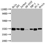 Western Blot; Positive WB detected in: Hela whole cell lysate, 293 whole cell lysate, Jurkat whole cell lysate, SH-SY5Y whole cell lysate, THP-1 whole cell lysate, PC-3 whole cell lysate, Rat brain tissue; All lanes: ATF5 antibody at 1:2000; Secondary; Goat polyclonal to rabbit IgG at 1/50000 dilution; Predicted band size: 31 kDa; Observed band size: 35 kDa