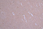 IHC image of CAC12007 diluted at 1:50 and staining in paraffin-embedded human brain tissue performed on a Leica BondTM system. After dewaxing and hydration, antigen retrieval was mediated by high pressure in a citrate buffer (pH 6.0). Section was blocked with 10% normal goat serum 30min at RT. Then primary antibody (1% BSA) was incubated at 4°C overnight. The primary is detected by a Goat anti-rabbit polymer IgG labeled by HRP and visualized using 0.19% DAB.