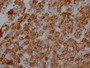 IHC image of CAC12008 diluted at 1:100 and staining in paraffin-embedded human liver tissue performed on a Leica BondTM system. After dewaxing and hydration, antigen retrieval was mediated by high pressure in a citrate buffer (pH 6.0). Section was blocked with 10% normal goat serum 30min at RT. Then primary antibody (1% BSA) was incubated at 4? overnight. The primary is detected by a Goat anti-rabbit IgG polymer labeled by HRP and visualized using 0.05% DAB.
