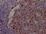 IHC image of CAC12010 diluted at 1:100 and staining in paraffin-embedded human tonsil tissue performed on a Leica BondTM system. After dewaxing and hydration, antigen retrieval was mediated by high pressure in a citrate buffer (pH 6.0). Section was blocked with 10% normal goat serum 30min at RT. Then primary antibody (1% BSA) was incubated at 4? overnight. The primary is detected by a Goat anti-rabbit IgG polymer labeled by HRP and visualized using 0.05% DAB.