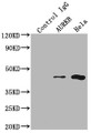 Immunoprecipitating AURKB in Hela whole cell lysate; Lane 1: Rabbit control IgG instead of CAC12010 in Hela whole cell lysate.For western blotting,a HRP-conjugated Protein G antibody was used as the secondary antibody (1/2000); Lane 2: CAC12010(2ug)+ Hela whole cell lysate(500ug); Lane 3: Hela whole cell lysate (10ug)