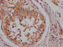 IHC image of CAC12012 diluted at 1:100 and staining in paraffin-embedded human testis tissue performed on a Leica BondTM system. After dewaxing and hydration, antigen retrieval was mediated by high pressure in a citrate buffer (pH 6.0). Section was blocked with 10% normal goat serum 30min at RT. Then primary antibody (1% BSA) was incubated at 4? overnight. The primary is detected by a Goat anti-rabbit IgG polymer labeled by HRP and visualized using 0.05% DAB.