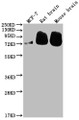 Western Blot; Positive WB detected in: MCF-7 whole cell lysate, Rat brain tissue, Mouse brain tissue; All lanes: BACE1 antibody at 1:2000; Secondary; Goat polyclonal to rabbit IgG at 1/50000 dilution; Predicted band size: 56, 53, 52, 49, 46, 43 kDa; Observed band size: 72 kDa