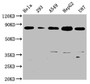 Western Blot; Positive WB detected in: Hela whole cell lysate, 293 whole cell lysate, A549 whole cell lysate, HepG2 whole cell lysate, U87 whole cell lysate; All lanes: BAG3 antibody at 0.73ug/ml; Secondary; Goat polyclonal to rabbit IgG at 1/50000 dilution; Predicted band size: 62 KDa; Observed band size: 80 KDa