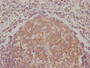 IHC image of CAC12015 diluted at 1:90 and staining in paraffin-embedded human lymph node tissue performed on a Leica BondTM system. After dewaxing and hydration, antigen retrieval was mediated by high pressure in a citrate buffer (pH 6.0). Section was blocked with 10% normal goat serum 30min at RT. Then primary antibody (1% BSA) was incubated at 4? overnight. The primary is detected by a biotinylated secondary antibody and visualized using an HRP conjugated SP system.