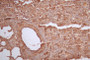 IHC image of CAC12016 diluted at 1:50 and staining in paraffin-embedded mouse lung tissue performed on a Leica BondTM system. After dewaxing and hydration, antigen retrieval was mediated by high pressure in a citrate buffer (pH 6.0). Section was blocked with 10% normal goat serum 30min at RT. Then primary antibody (1% BSA) was incubated at 4°C overnight. The primary is detected by a Goat anti-rabbit polymer IgG labeled by HRP and visualized using 0.53% DAB.