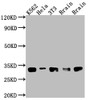 Western Blot; Positive WB detected in: K562 whole cell lysate, Hela whole cell lysate, NIH/3T3 whole cell lysate, Rat Brain whole cell lysate, Mouse Brain whole cell lysate; All lanes: Bcl-XL antibody at 1:1000; Secondary; Goat polyclonal to rabbit IgG at 1/50000 dilution; Predicted band size: 27, 19, 26 kDa; Observed band size: 30 kDa