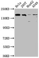 Western Blot; Positive WB detected in: Hela whole cell lysate, 293T whole cell lysate, HepG2 whole cell lysate, A549 whole cell lysate; All lanes: BRD4 antibody at 1:1500; Secondary; Goat polyclonal to rabbit IgG at 1/50000 dilution; Predicted band size: 153, 81, 89 kDa; Observed band size: 153 kDa