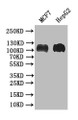 Western Blot; Positive WB detected in: MCF7 whole cell lysate, HEPG2 whole cell lysate; All lanes: BACH1/BRIP1 antibody at 1:1000; Secondary; Goat polyclonal to rabbit IgG at 1/50000 dilution; Predicted band size: 105 kDa; Observed band size: 105 kDa