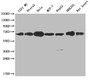 Western Blot; Positive WB detected in: U251 whole cell lysate, Ntera-2 whole cell lysate, Hela whole cell lysate, MCF-7 whole cell lysate, HepG2 whole cell lysate, HEK293 whole cell lysate, Rat heart tissue; All lanes: CBX2 antibody at 1:2000; Secondary; Goat polyclonal to rabbit IgG at 1/50000 dilution; Predicted band size: 57, 24 kDa; Observed band size: 60-72 kDa