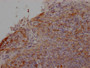 IHC image of CAC12050 diluted at 1:100 and staining in paraffin-embedded human tonsil tissue performed on a Leica BondTM system. After dewaxing and hydration, antigen retrieval was mediated by high pressure in a citrate buffer (pH 6.0). Section was blocked with 10% normal goat serum 30min at RT. Then primary antibody (1% BSA) was incubated at 4? overnight. The primary is detected by a Goat anti-rabbit IgG polymer labeled by HRP and visualized using 0.05% DAB.