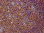 IHC image of CAC12056 diluted at 1:100 and staining in paraffin-embedded human tonsil tissue performed on a Leica BondTM system. After dewaxing and hydration, antigen retrieval was mediated by high pressure in a citrate buffer (pH 6.0). Section was blocked with 10% normal goat serum 30min at RT. Then primary antibody (1% BSA) was incubated at 4? overnight. The primary is detected by a Goat anti-rabbit IgG polymer labeled by HRP and visualized using 0.05% DAB.