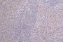 IHC image of CAC12062 diluted at 1:100 and staining in paraffin-embedded human spleen tissue performed on a Leica BondTM system. After dewaxing and hydration, antigen retrieval was mediated by high pressure in a citrate buffer (pH 6.0). Section was blocked with 10% normal goat serum 30min at RT. Then primary antibody (1% BSA) was incubated at 4°C overnight. The primary is detected by a Goat anti-rabbit polymer IgG labeled by HRP and visualized using 0.25% DAB.