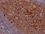 IHC image of CAC12063 diluted at 1:100 and staining in paraffin-embedded human tonsil tissue performed on a Leica BondTM system. After dewaxing and hydration, antigen retrieval was mediated by high pressure in a citrate buffer (pH 6.0). Section was blocked with 10% normal goat serum 30min at RT. Then primary antibody (1% BSA) was incubated at 4? overnight. The primary is detected by a Goat anti-rabbit IgG polymer labeled by HRP and visualized using 0.05% DAB.