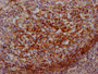 IHC image of CAC12067 diluted at 1:100 and staining in paraffin-embedded human lung tissue performed on a Leica BondTM system. After dewaxing and hydration, antigen retrieval was mediated by high pressure in a citrate buffer (pH 6.0). Section was blocked with 10% normal goat serum 30min at RT. Then primary antibody (1% BSA) was incubated at 4? overnight. The primary is detected by a Goat anti-rabbit IgG polymer labeled by HRP and visualized using 0.05% DAB.