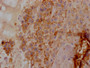 IHC image of CAC12067 diluted at 1:100 and staining in paraffin-embedded human placenta tissue performed on a Leica BondTM system. After dewaxing and hydration, antigen retrieval was mediated by high pressure in a citrate buffer (pH 6.0). Section was blocked with 10% normal goat serum 30min at RT. Then primary antibody (1% BSA) was incubated at 4? overnight. The primary is detected by a Goat anti-rabbit IgG polymer labeled by HRP and visualized using 0.05% DAB.