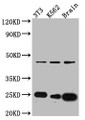 Western Blot; Positive WB detected in: NIH/3T3 whole cell lysate, K562 whole cell lysate, Mouse Brain whole cell lysate; All lanes: CDC42 antibody at 1:1000; Secondary; Goat polyclonal to rabbit IgG at 1/50000 dilution; Predicted band size: 22, 22 kDa; Observed band size: 24 kDa