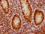 IHC image of CAC12078 diluted at 1:126.5 and staining in paraffin-embedded human appendix tissue performed on a Leica BondTM system. After dewaxing and hydration, antigen retrieval was mediated by high pressure in a citrate buffer (pH 6.0). Section was blocked with 10% normal goat serum 30min at RT. Then primary antibody (1% BSA) was incubated at 4? overnight. The primary is detected by a biotinylated secondary antibody and visualized using an HRP conjugated SP system.