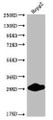 Western Blot; Positive WB detected in: HepG2 whole cell lysate; All lanes: CDX1 antibody at 1:2000; Secondary; Goat polyclonal to rabbit IgG at 1/50000 dilution; Predicted band size: 29, 15 kDa; Observed band size: 25-30 kDa