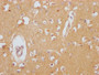 IHC image of CAC12095 diluted at 1:100 and staining in paraffin-embedded human brain tissue performed on a Leica BondTM system. After dewaxing and hydration, antigen retrieval was mediated by high pressure in a citrate buffer (pH 6.0). Section was blocked with 10% normal goat serum 30min at RT. Then primary antibody (1% BSA) was incubated at 4? overnight. The primary is detected by a Goat anti-rabbit IgG polymer labeled by HRP and visualized using 0.05% DAB.