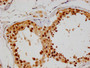 IHC image of CAC12101 diluted at 1:100 and staining in paraffin-embedded human testis tissue performed on a Leica BondTM system. After dewaxing and hydration, antigen retrieval was mediated by high pressure in a citrate buffer (pH 6.0). Section was blocked with 10% normal goat serum 30min at RT. Then primary antibody (1% BSA) was incubated at 4°C overnight. The primary is detected by a Goat anti-rabbit polymer IgG labeled by HRP and visualized using 0.05% DAB.