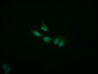 Immunofluorescence staining of A549 cell with CAC12101 at 1:50, counter-stained with DAPI. The cells were fixed in 4% formaldehyde and blocked in 10% normal Goat Serum. The cells were then incubated with the antibody overnight at 4°C. The secondary antibody was Alexa Fluor 535-congugated AffiniPure Goat Anti-Rabbit IgG(H+L).