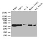 Western Blot; Positive WB detected in: K562 whole cell lysate, THP-1 whole cell lysate, Mouse brain tissue lysate, Rat brain tissue lysate,; All lanes: CREB antibody at 1:1000; Secondary; Goat polyclonal to rabbit IgG at 1/50000 dilution; Predicted band size: 36 kDa; Observed band size: 36 kDa