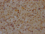 IHC image of CAC12106 diluted at 1:100 and staining in paraffin-embedded human ovarian tissue performed on a Leica BondTM system. After dewaxing and hydration, antigen retrieval was mediated by high pressure in a citrate buffer (pH 6.0). Section was blocked with 10% normal goat serum 30min at RT. Then primary antibody (1% BSA) was incubated at 4? overnight. The primary is detected by a Goat anti-rabbit IgG polymer labeled by HRP and visualized using 0.05% DAB.