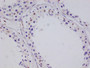 IHC image of CAC12108 diluted at 1:100 and staining in paraffin-embedded human testis tissue performed on a Leica BondTM system. After dewaxing and hydration, antigen retrieval was mediated by high pressure in a citrate buffer (pH 6.0). Section was blocked with 10% normal goat serum 30min at RT. Then primary antibody (1% BSA) was incubated at 4°C overnight. The primary is detected by a Goat anti-rabbit polymer IgG labeled by HRP and visualized using 0.05% DAB.