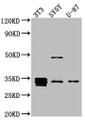 Western Blot; Positive WB detected in: NIH/3T3 whole cell lysate, SH-SY5Y whole cell lysate, U-87 whole cell lysate; All lanes: Cyclin D1 antibody at 1:1000; Secondary; Goat polyclonal to rabbit IgG at 1/50000 dilution; Predicted band size: 34 kDa; Observed band size: 34 kDa