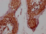 IHC image of CAC12116 diluted at 1:100 and staining in paraffin-embedded human testis tissue performed on a Leica BondTM system. After dewaxing and hydration, antigen retrieval was mediated by high pressure in a citrate buffer (pH 6.0). Section was blocked with 10% normal goat serum 30min at RT. Then primary antibody (1% BSA) was incubated at 4? overnight. The primary is detected by a Goat anti-rabbit IgG polymer labeled by HRP and visualized using 0.05% DAB.