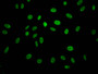 Immunofluorescence staining of Hela Cells with CAC12116 at 1:50, counter-stained with DAPI. The cells were fixed in 4% formaldehyde, permeated by 0.2% TritonX-100, and blocked in 10% normal Goat Serum. The cells were then incubated with the antibody overnight at 4?. Nuclear DNA was labeled in blue with DAPI. The secondary antibody was FITC-conjugated AffiniPure Goat Anti-Rabbit IgG (H+L).