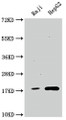 Western Blot; Positive WB detected in: Raji whole cell lysate, HepG2 whole cell lysate; All lanes: Cyclophilin A antibody at 1:1500; Secondary; Goat polyclonal to rabbit IgG at 1/50000 dilution; Predicted band size: 19, 12 kDa; Observed band size: 19 kDa