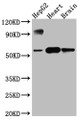 Western Blot; Positive WB detected in: HepG2 whole cell lysate, Rat Heart whole cell lysate, Rat Brain whole cell lysate; All lanes: CYP17A1 antibody at 1:1000; Secondary; Goat polyclonal to rabbit IgG at 1/50000 dilution; Predicted band size: 58 kDa; Observed band size: 58 kDa